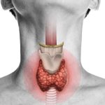 آیا می‌توان بیماری تیروئید را با درمان‌های گیاهی به طور کامل مهار کرد؟