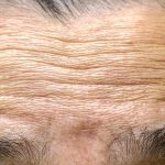 کشف عامل اصلی چروک شدن پوست با افزایش سن