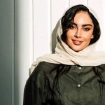 تغییر چهره ترلان پروانه در عکس جدیدش