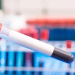 انقلابی در تشخیص سرطان؛ دانشمندان راهی برای شناسایی زودهنگام تومورها پیدا کردند