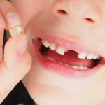 تعبیر خواب دندان جلو بالا افتاده + معنی دندان جلو بالا افتاده در خواب های ما چیست تعبیر خواب دندان جلو بالا افتاده + معنی دندان جلو بالا افتاده در خواب های ما چیست