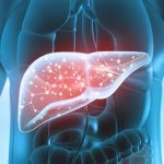 خستگی شدید و مشکلات عصبی از علائم نارسایی کبدی است؟