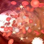 این بیماری می‌تواند موجب پیری زودرس رگ‌های خونی شود