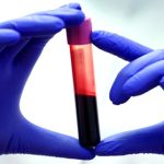 اگر این نشانه‌ها را دارید، احتمالا شمع تولد 100 سالگی خود را فوت می‌کنید