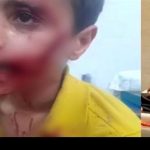 مرگ دلخراش کودک ۱۱ ساله درپی حمله ‌سگ‌های ولگرد