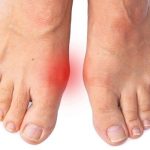 اگر درد شست پا این مطلب را بخوانید اگر درد شست پا این مطلب را بخوانید