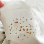 رفع زنگ زدگی پرده با روش‌های خانگی و کم ‌هزینه