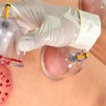 خواص حجامت برای سینوزیت + تاثیر حجامت کردن برای درمان سینوزیت خواص حجامت برای سینوزیت + تاثیر حجامت کردن برای درمان سینوزیت