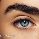کاشت ابرو بدون جراحی به روش میکرو در تهران
